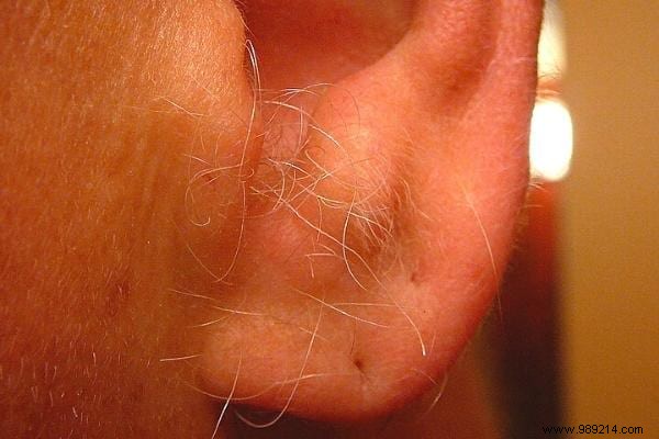 I have ear hair! Tricks That Work To Eradicate Them. 