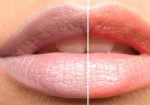 Tobacco Blackened Lips? 3 Remedies To Detach Them In 1 Week. 