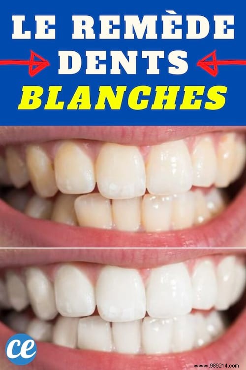 Whiten Your Teeth Fast With This 100% Natural Tip. 