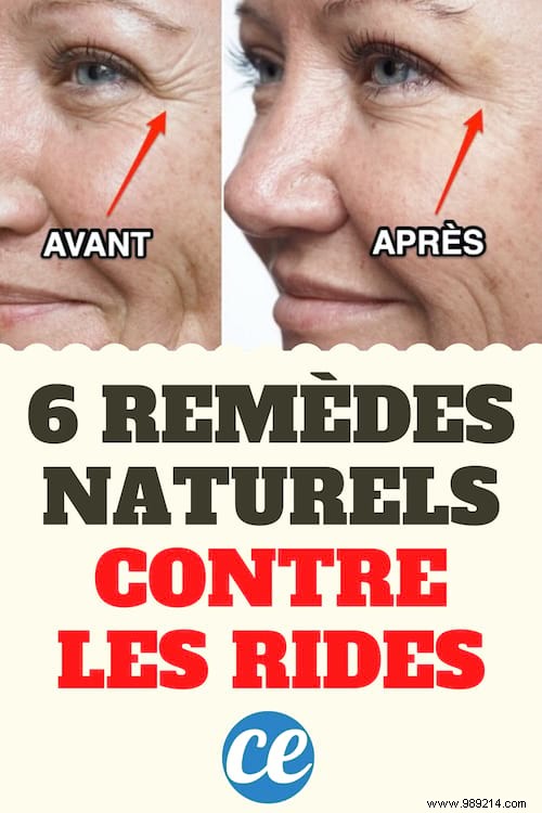 6 Miracle Remedies For Wrinkles You Already Have In Your Kitchen. 