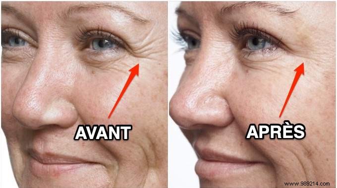 6 Miracle Remedies For Wrinkles You Already Have In Your Kitchen. 