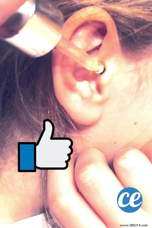 How to Remove an Earwax Blockage? The Natural &Effective Remedy. 