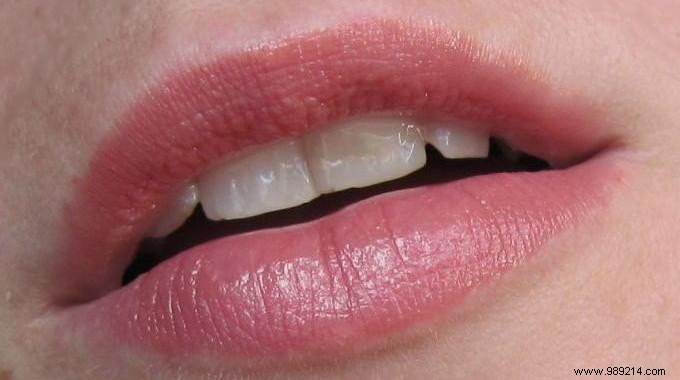 Grandma s Infallible Remedy for Chapped Lips. 