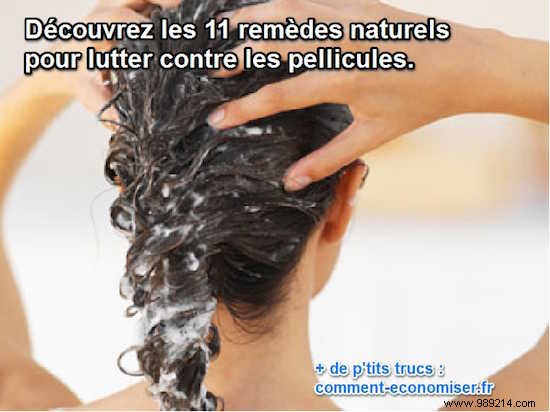 11 Natural Remedies To Get Rid Of Dandruff. 