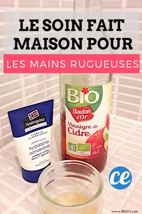 The Miracle Remedy For Dry, Damaged And Rough Hands. 