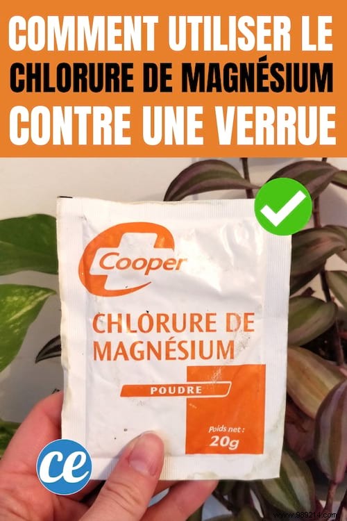 How To Use Magnesium Chloride To Get Rid Of A Wart (Painlessly). 