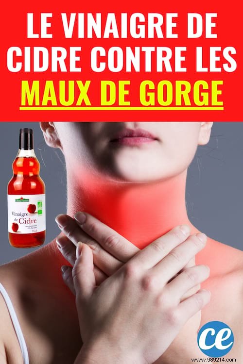 4 Apple Cider Vinegar Remedies for Sore Throat (Quick and Effective). 
