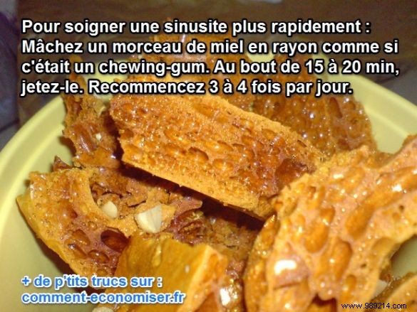The Natural Remedy to Cure Sinusitis Faster. 