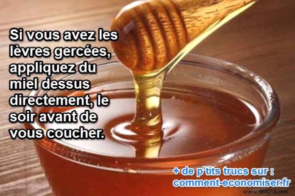 The Gentle and Natural Remedy for Chapped Skin. 