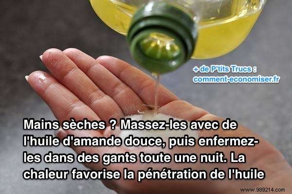 The Best Remedy for Dry Hands. 