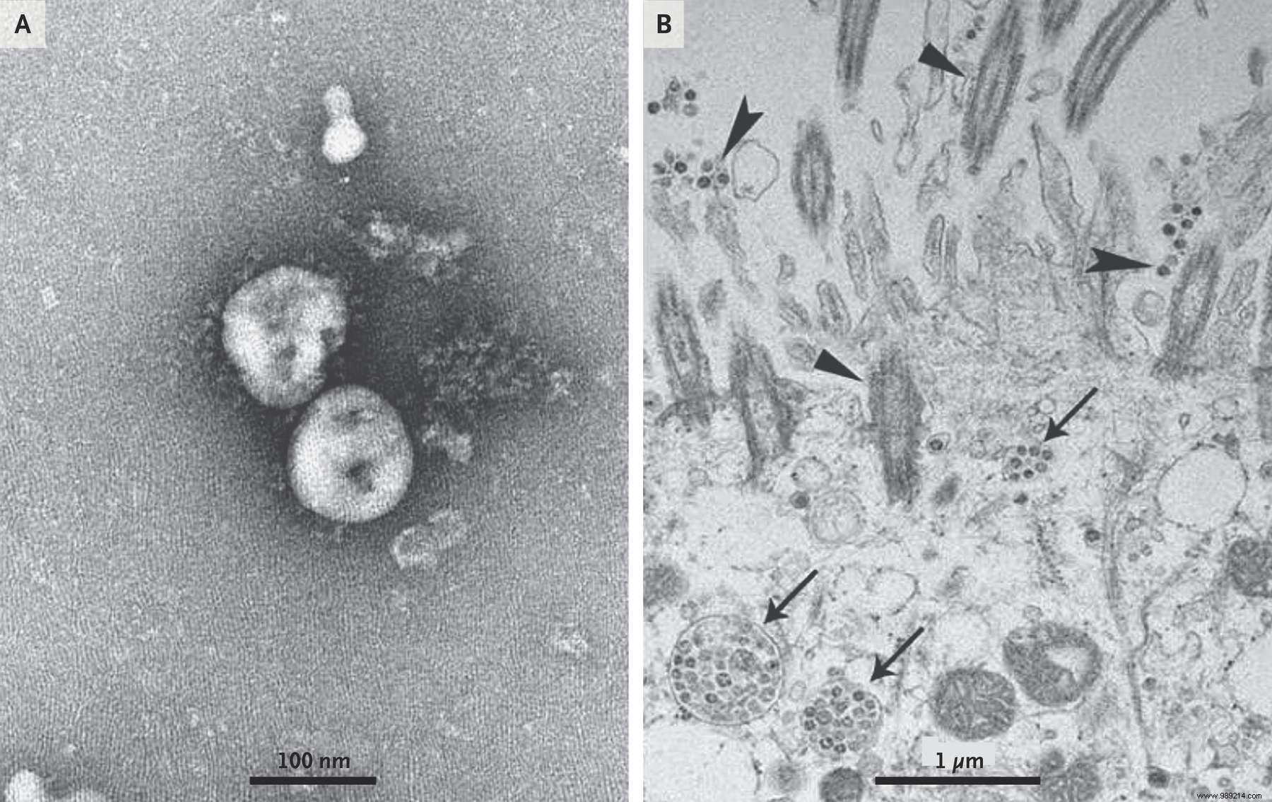 Australian researchers have replicated the Chinese coronavirus. Why is this good news? 