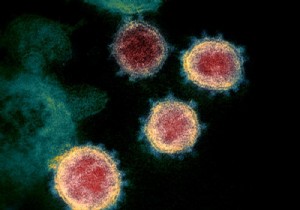 What if the Covid-19 epidemic had started in September 2019 and elsewhere than in Wuhan? 