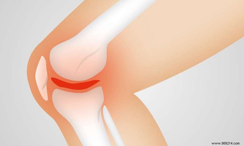 Will we ever be able to cure osteoarthritis? New studies keep hope alive 